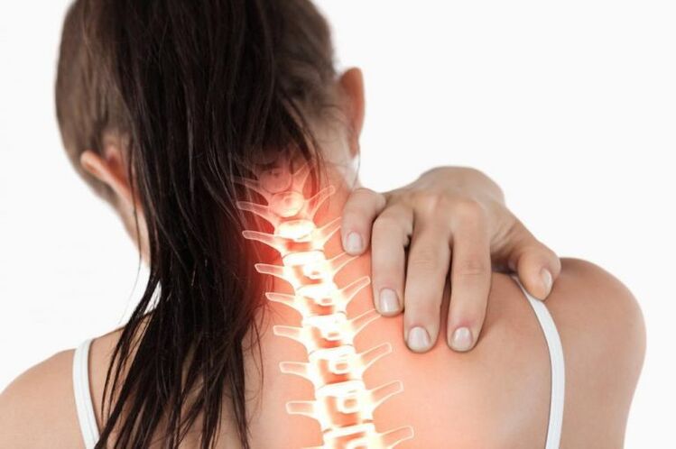 El dolor de cuello es un síntoma de la osteocondrosis de la columna cervical. 