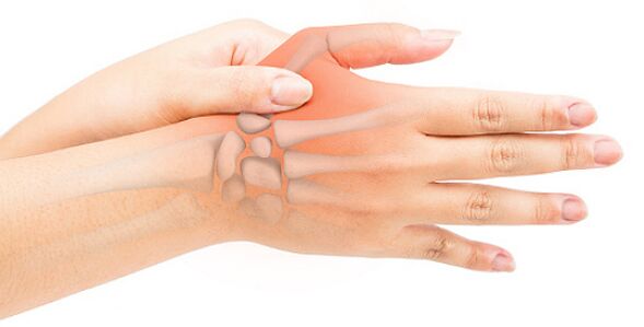 La ligamentitis estenosante bloquea el dedo en posición flexionada. 