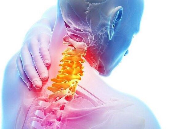 osteocondrosis