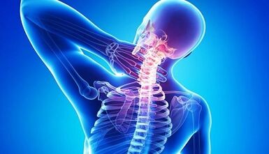 Síntomas y tratamiento de la osteocondrosis cervical