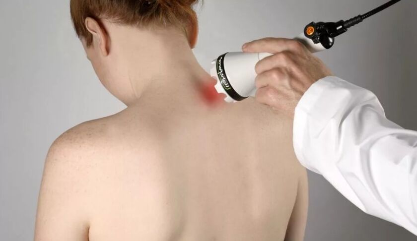 Método fisioterapéutico para tratar la osteocondrosis cervical
